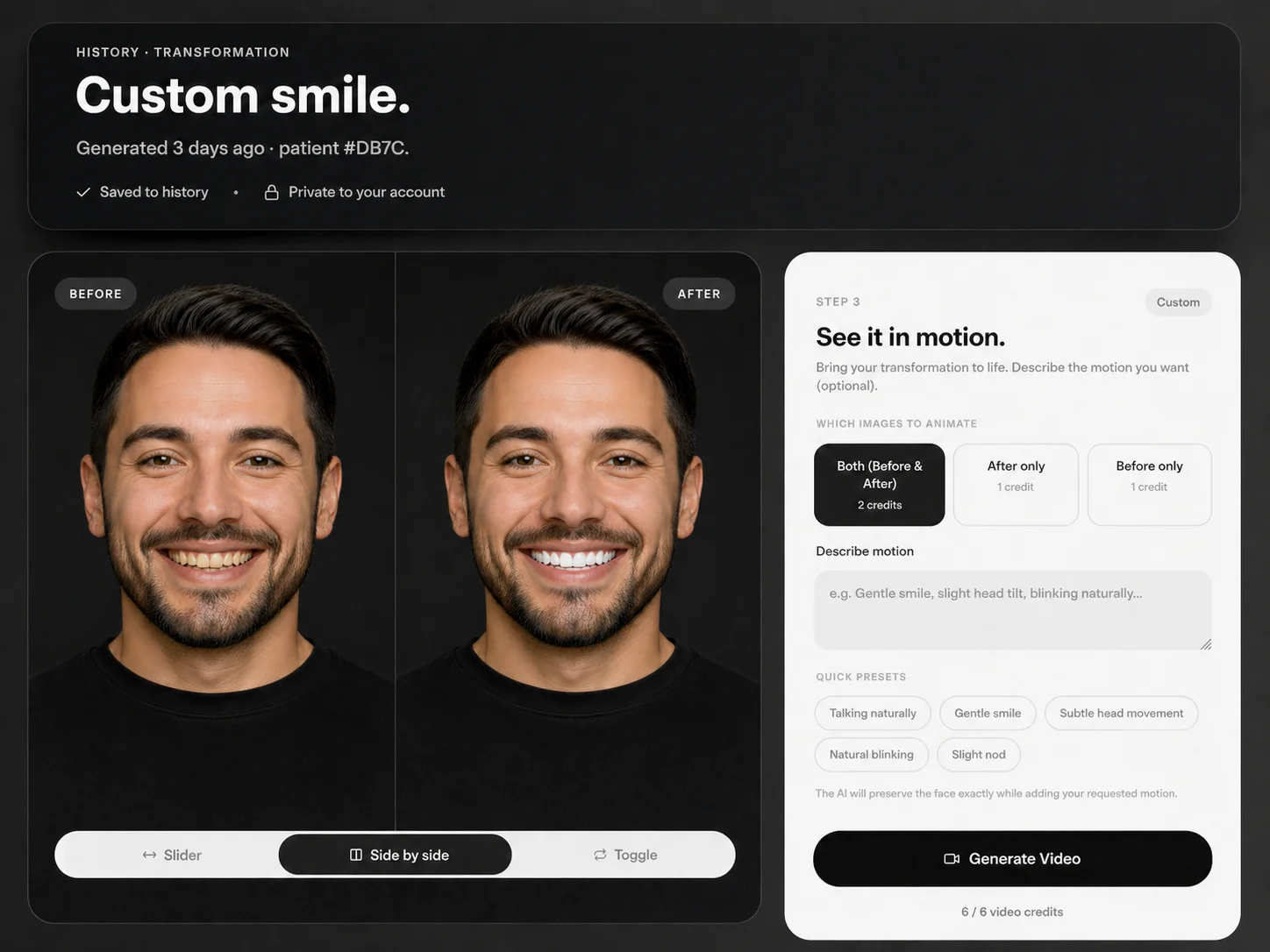 DentAI product mockup showing a before and after smile preview