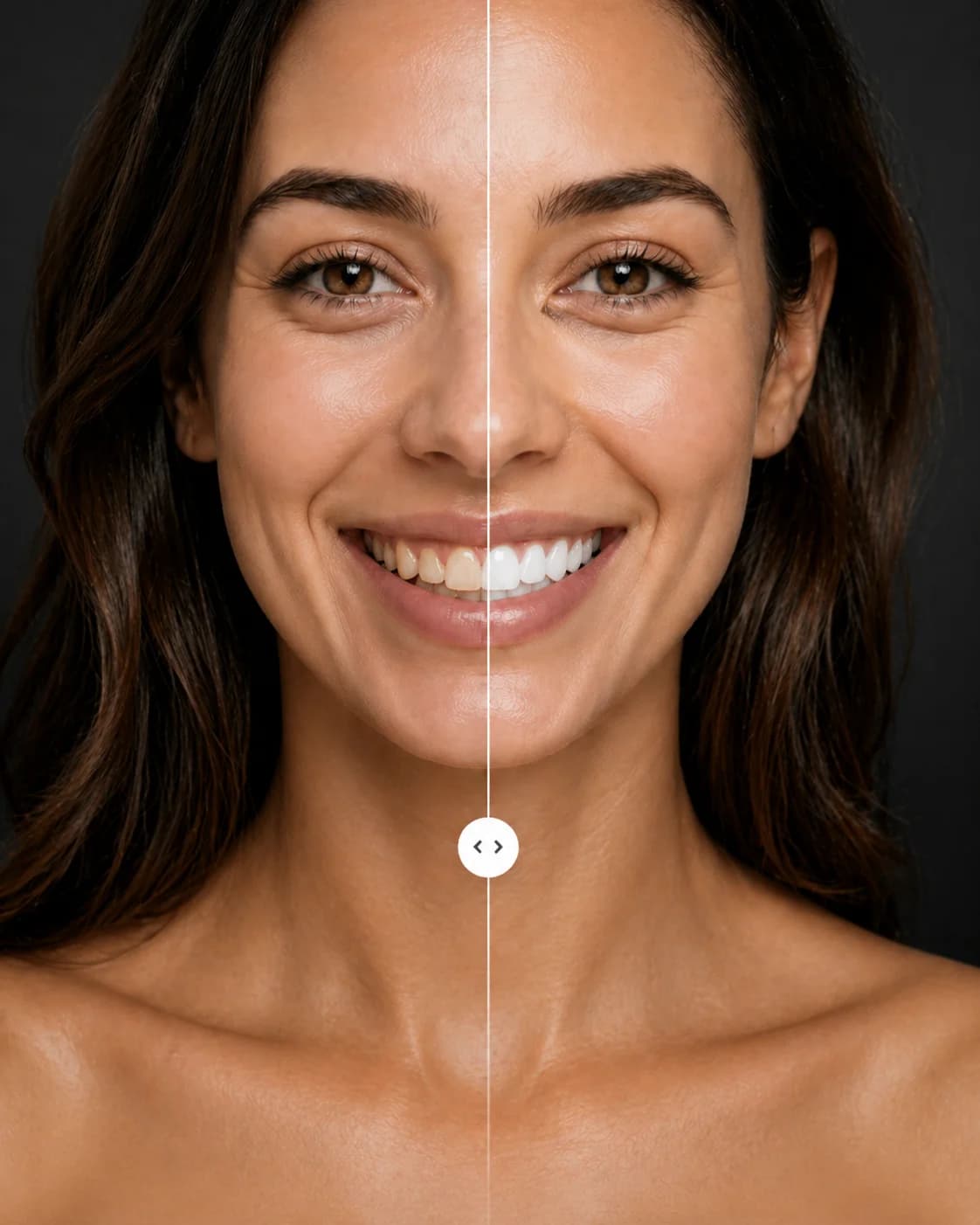 Before and after AI smile preview