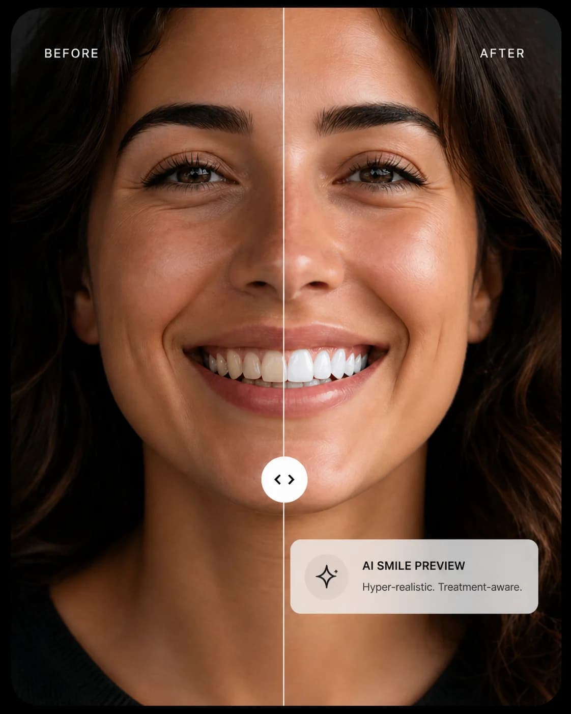 Before and after AI dental smile preview